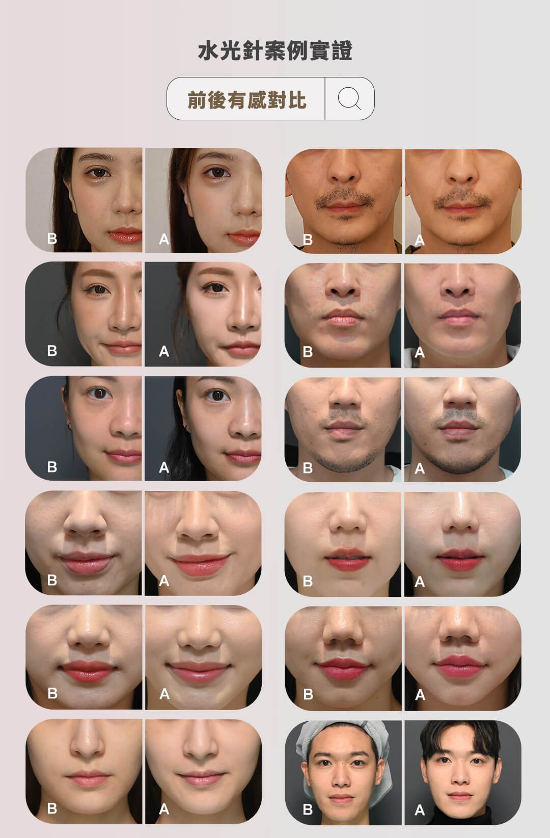 水光針實證案例